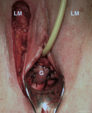 Click on image to zoom