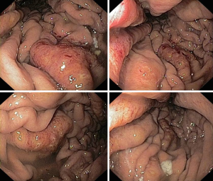 Click on image to zoom