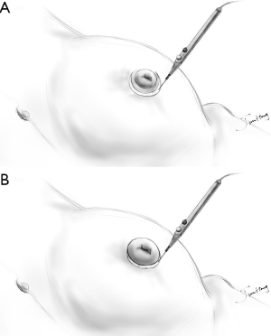Click on image to zoom