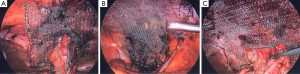 Click on image to zoom