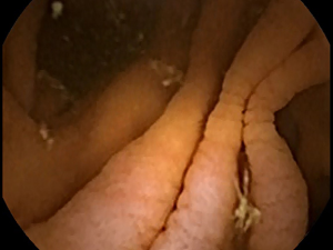 Click on image to zoom