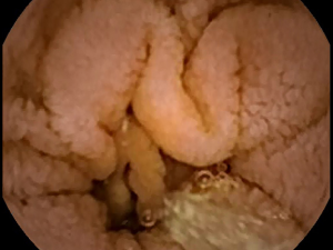 Click on image to zoom