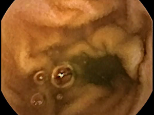 Click on image to zoom
