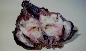 Click on image to zoom Figure 2