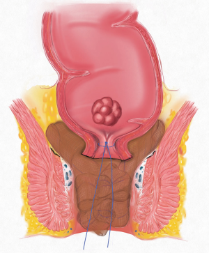 Click on image to zoom