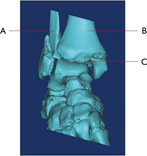 Click on image to zoom