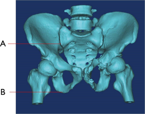 Click on image to zoom