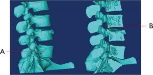 Click on image to zoom