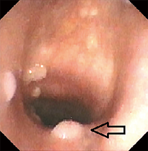 Click on image to zoom