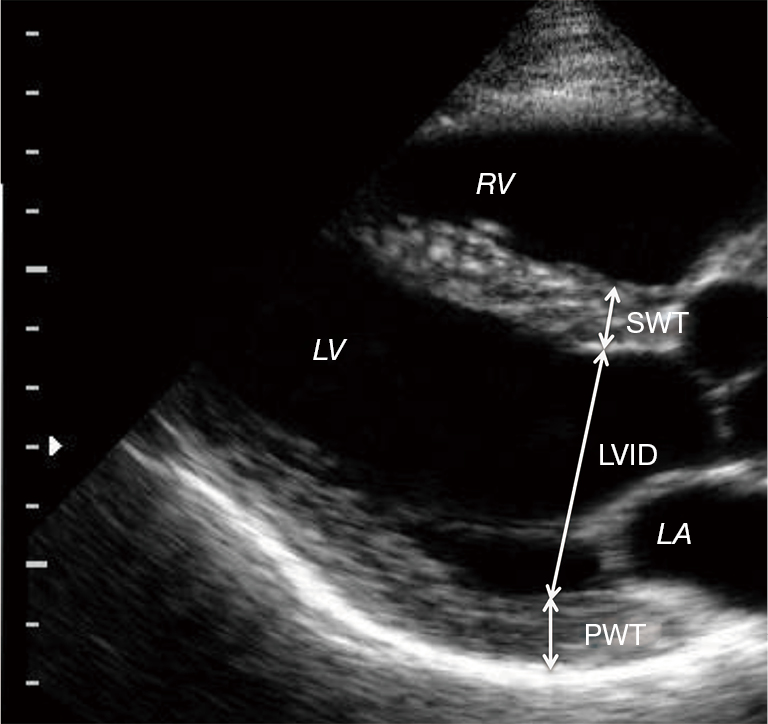 Can the echocardiographic LV mass equation reliably demonstrate stable LV mass following acute ...