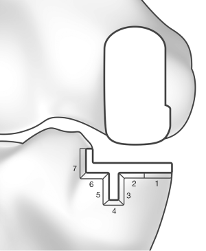 Click on image to zoom