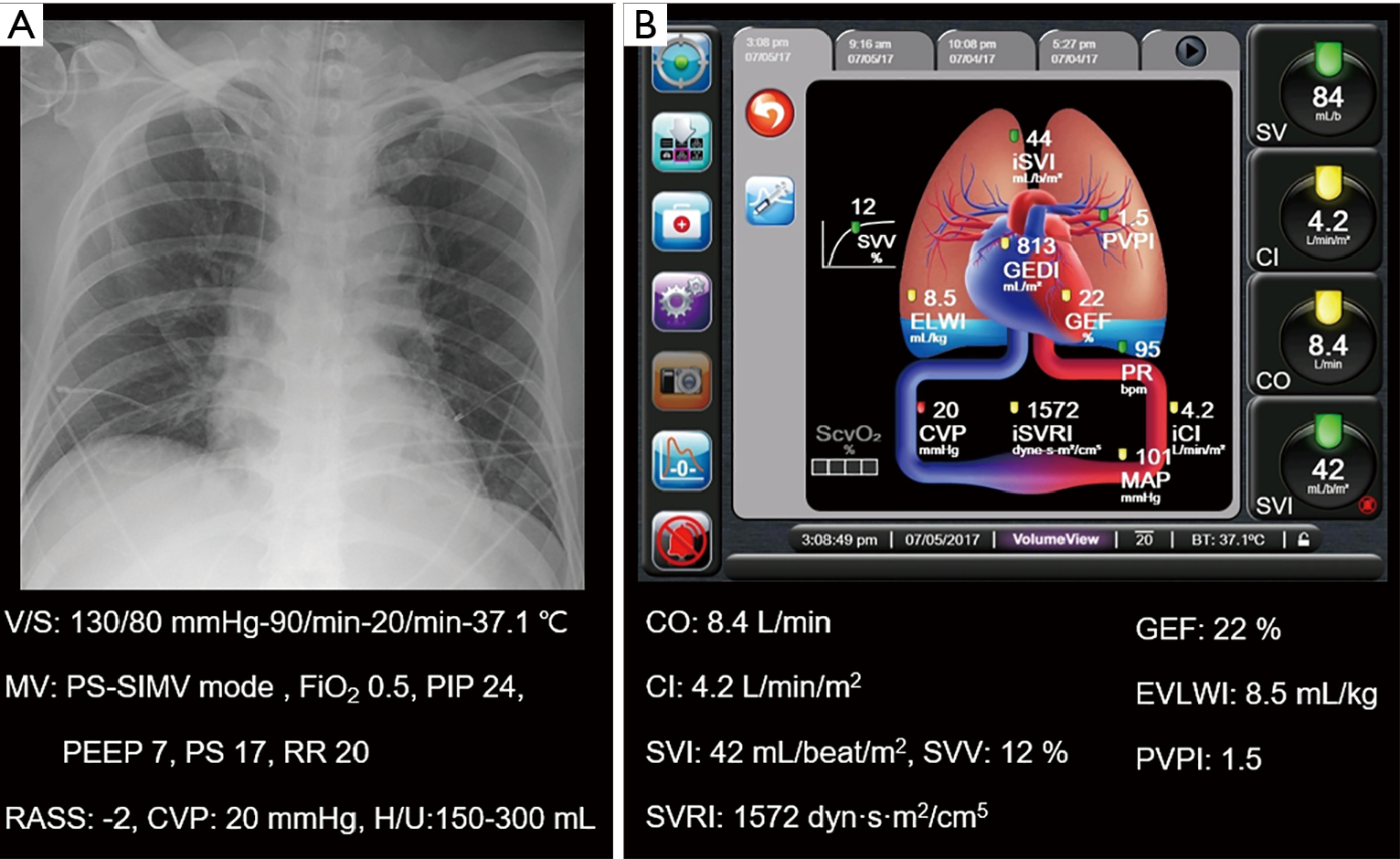 Are management decisions in critical patients changed with use of