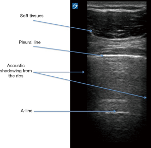 Click on image to zoom