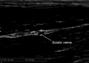 Click on image to zoom