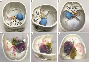 Click on image to zoom