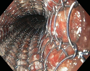 Click on image to zoom