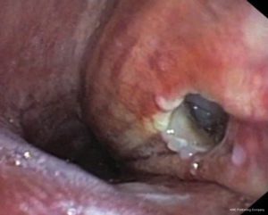 Click on image to zoom
