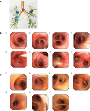 Click on image to zoom
