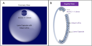 Click on image to zoom