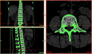 Click on image to zoom