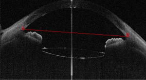 Click on image to zoom