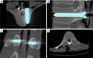 Click on image to zoom