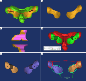 Click on image to zoom