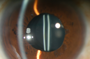 Click on image to zoom