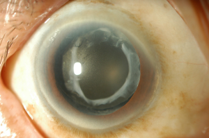 Click on image to zoom