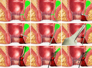 Click on image to zoom