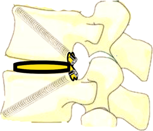 Click on image to zoom