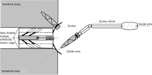 Click on image to zoom