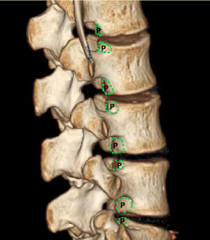 Click on image to zoom