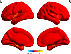 Click on image to zoom