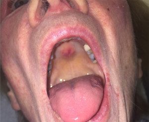 Click on image to zoom