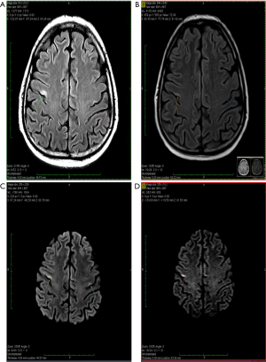 Click on image to zoom