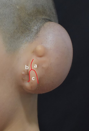 Click on image to zoom