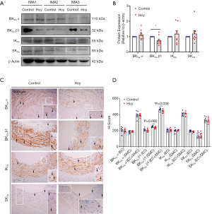 Click on image to zoom