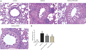 Click on image to zoom