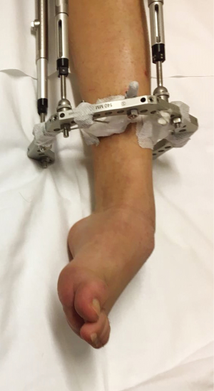 Click on image to zoom