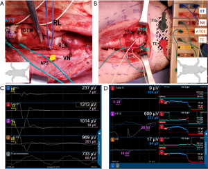 Click on image to zoom