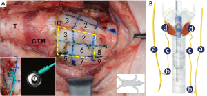 Click on image to zoom