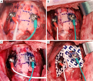 Click on image to zoom