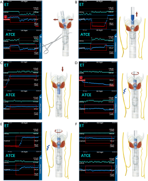 Click on image to zoom