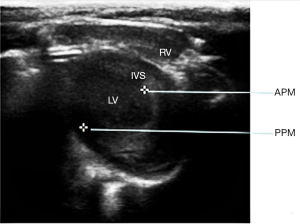 Click on image to zoom