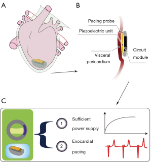 Click on image to zoom