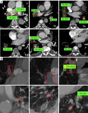 Click on image to zoom