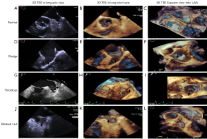 Click on image to zoom