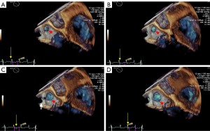 Click on image to zoom