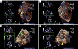 Click on image to zoom